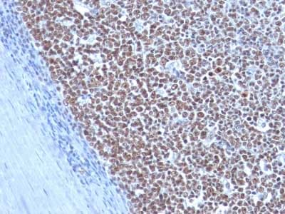 Cyclin B1 Antibody Ccnb1 1098 Ab212977  Immunohistochemistry Formalin Pfa Fixed Paraffin Embedded Sections Img66520