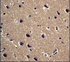Ppp1r1a Antibody Ep902y Bsa And Azide Free Ab247299  Immunohistochemistry Formalin Pfa Fixed Paraffin Embedded Sections Img117887