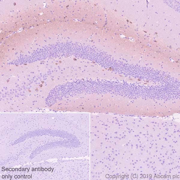 Anti-Reelin antibody [EPR22515-75](AB230820)