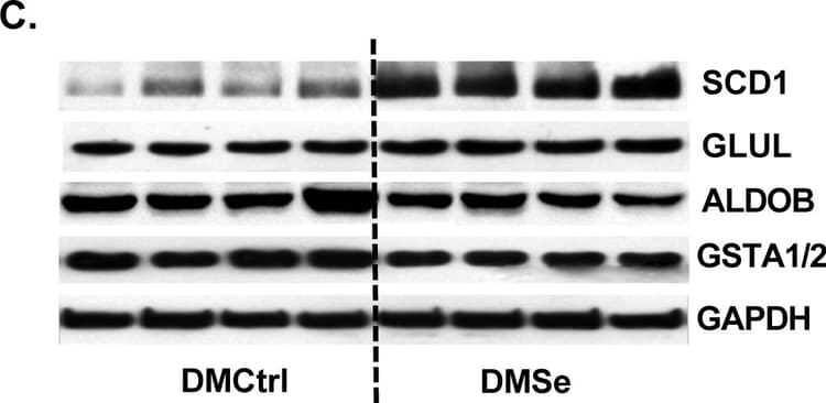 Anti-Aldolase B + Aldolase C antibody [EPR3138Y](ab75751)