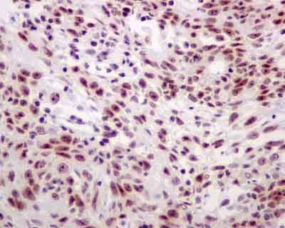Nhp2l1 Antibody Epr11671 Ab181982  Immunohistochemistry Formalin Pfa Fixed Paraffin Embedded Sections Img89627