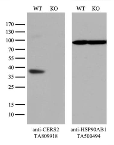 Anti-CerS2 antibody [OTI3D9](AB279372)