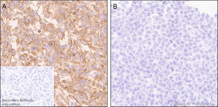 Pan Cytokeratin Antibody Epr28285 45 Bsa And Azide Free Ab308263  Immunohistochemistry Formalin Pfa Fixed Paraffin Embedded Sections Img408896