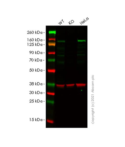 Anti-Hamartin Antibody [EPR24364-109] (AB270967)