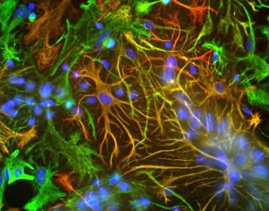 Anti-Vimentin antibody(AB24525)