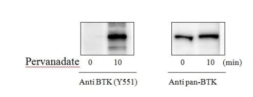 Phospho-BTK (Y551) ELISA Kit(AB279751)