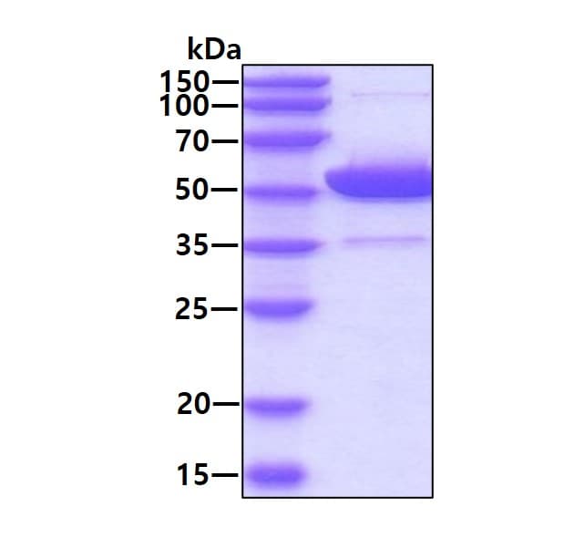 Recombinant human ALDH2 protein (Active)(AB87415)