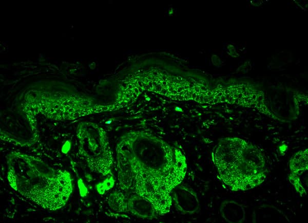 Anti-SOD2/MnSOD antibody(AB13534)