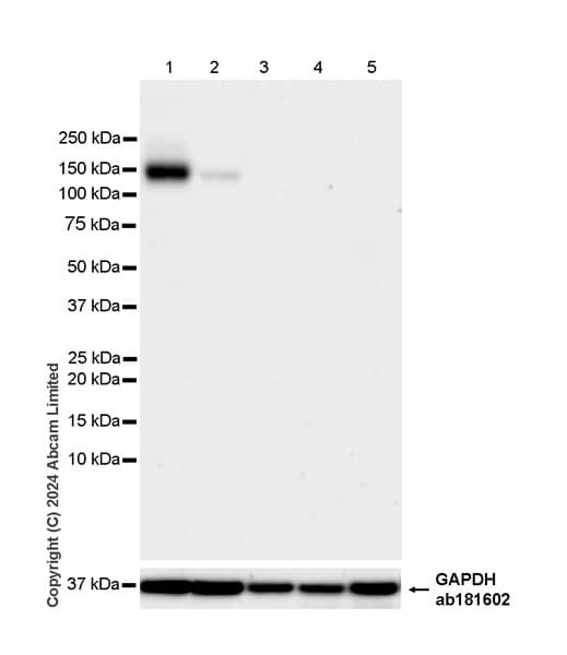 Pmca2 Antibody Epr28923 56 Bsa And Azide Free Ab319151  Western Blot Img435173