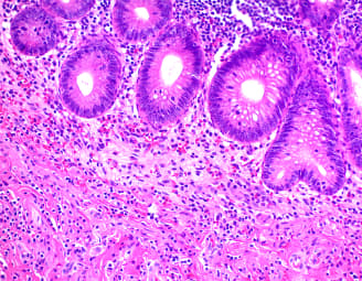 H&E Staining Kit (Hematoxylin and Eosin)(AB245880)