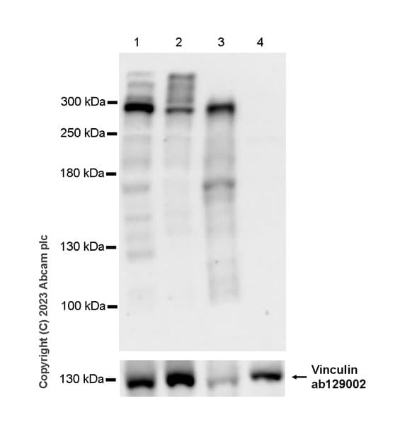 Anti-Nesprin 2 antibody [EPR28137-54](AB314872)