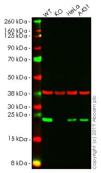Anti-Mad2L1 antibody [EPR9853(B)](AB150371)