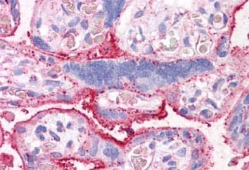 Slc31a1 Ctr1 Antibody Ab133385  Immunohistochemistry Formalin Pfa Fixed Paraffin Embedded Sections Img109738