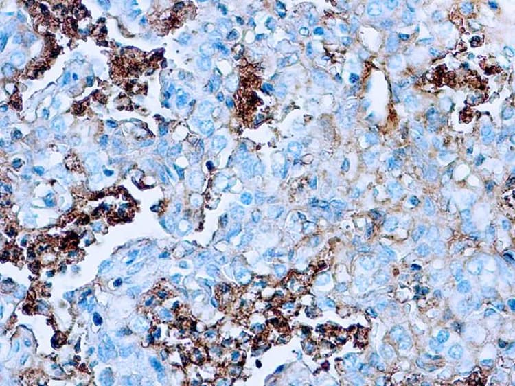 Anti-Human Serum Albumin antibody(AB2406)