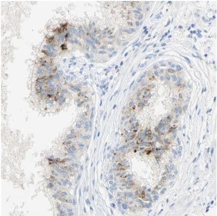 Anti-GDF15 antibody(AB211364)