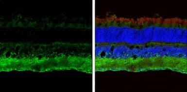 Abat Gaba T Antibody Ab152134  Immunohistochemistry Frozen Sections Img452044