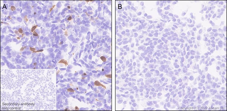 Anti-IL-6 antibody [EPR23819-103](AB290735)