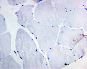 Anti-CD19 antibody [EPR5906](AB134114)
