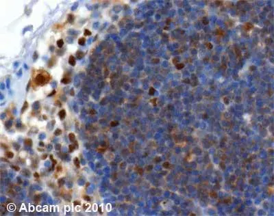 Anti-SQSTM1 / p62 antibody [2C11] - BSA and Azide free(AB56416)