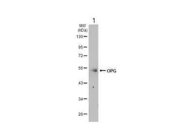 Anti-Osteoprotegerin antibody(AB183910)