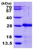 Recombinant Human CIB2 protein(AB104126)