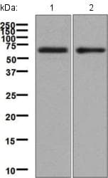 Il 5ra Antibody Epr54502 Bsa And Azide Free Ab248740  Western Blot Img124496