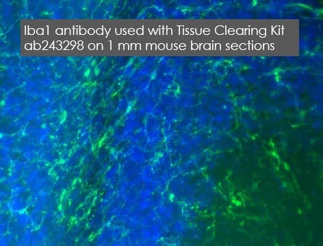 Anti-Iba1 antibody [EPR16589](AB178847)