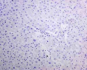Anti-TTF1/Nkx2-1 antibody [EPR8190-138] - BSA and Azide free(AB227576)