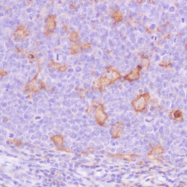Pd L1 Antibody Sp142 C Terminal Ab228462  Immunohistochemistry Formalin Pfa Fixed Paraffin Embedded Sections Img118414