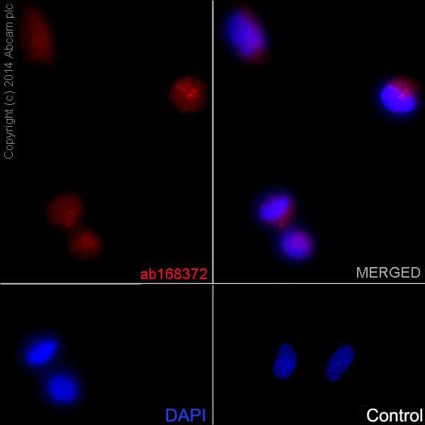 Anti-Fbx32 antibody [EPR9148(2)](AB168372)