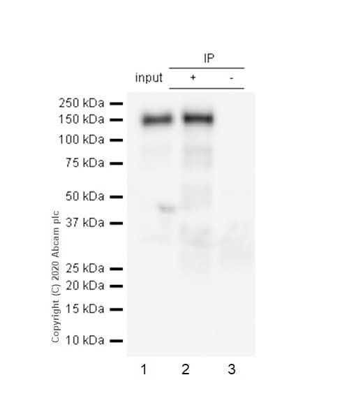 Anti-pan Cadherin antibody [EPR1792Y] - Intercellular Junction Marker(AB51034)
