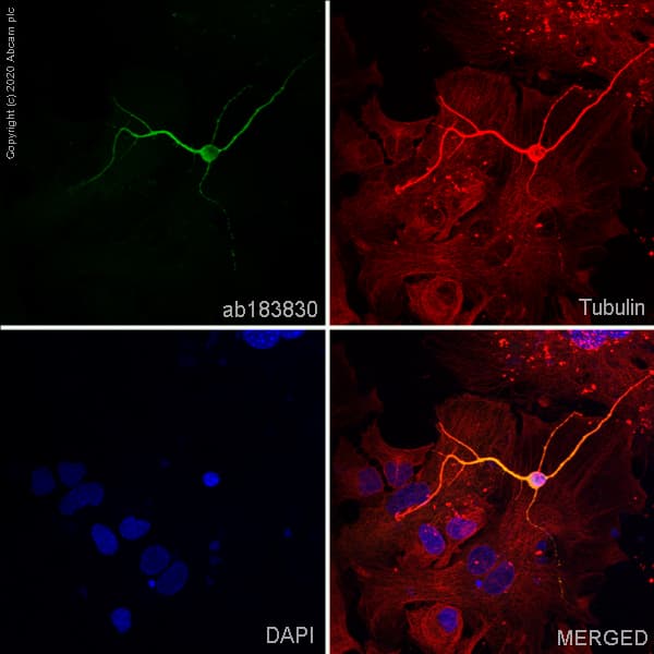 Anti-MAP2 antibody [EPR19691](AB183830)