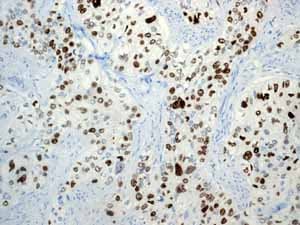 Anti-Ki67 antibody [EPR3610](AB92742)