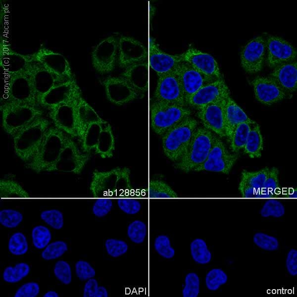 Anti-Fatty Acid Synthase antibody [EPR7465] - BSA and Azide free(AB227083)
