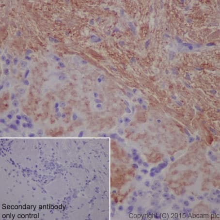 Olfactory Marker Protein Omp Antibody Epr19157 Bsa And Azide Free Ab250713  Immunohistochemistry Formalin Pfa Fixed Paraffin Embedded Sections Img43592