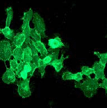 Anti-EGFR antibody [EPR39Y](AB76153)
