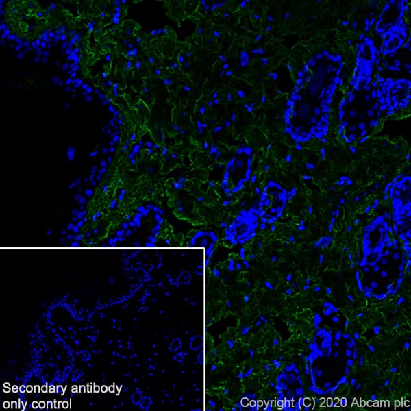 Anti-Collagen I antibody [EPR24331-53](AB270993)