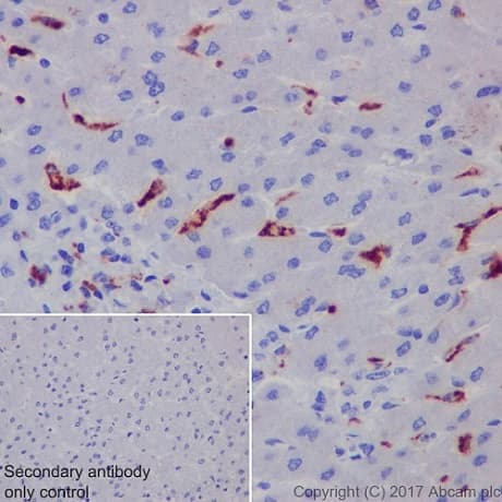 Anti-CD68 antibody [EPR20545](AB213363)