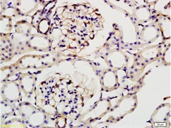 Integrin Linked Ilk Antibody Ab217025  Immunohistochemistry Formalin Pfa Fixed Paraffin Embedded Sections Img112188