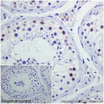 Caspase 2l Antibody Epr16790 Ab179519  Immunohistochemistry Formalin Pfa Fixed Paraffin Embedded Sections Img96996