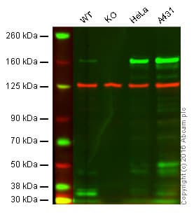 Anti-MSH6 antibody [EPR3945](AB92471)