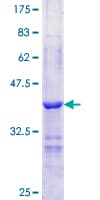 Recombinant Human Perilipin-1 protein(AB112340)