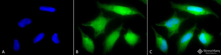 Rab5 Antibody Early Endosome Marker Ab13253  Immunocytochemistry Immunofluorescence Img438319
