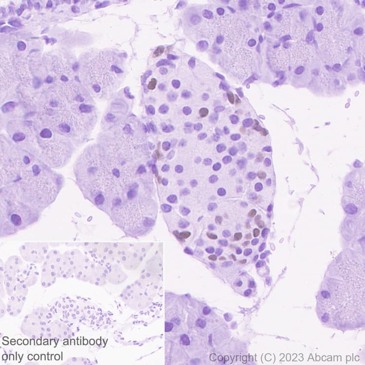 Arx Antibody Epr27481 32 Ab308260  Immunohistochemistry Formalin Pfa Fixed Paraffin Embedded Sections Img408867