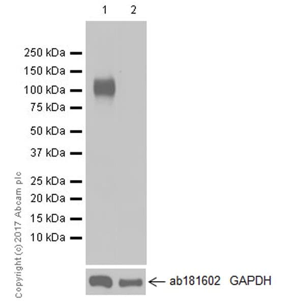 Anti-CD31 antibody [EPR17260-263](AB222783)