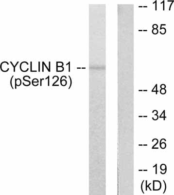 Cyclin B1 Phospho S126 Antibody Ab55184  Western Blot Img25654