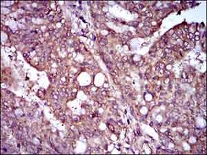 Rex1 Antibody 5e11e7 Ab175431  Immunohistochemistry Formalin Pfa Fixed Paraffin Embedded Sections Img97020