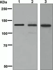 Anti-Collagen I antibody [EPR7785](AB138492)