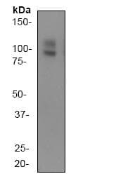 Anti-Amyloid Precursor Protein antibody [Y188](AB32136)