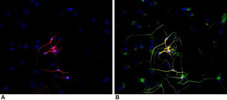 Anti-beta III Tubulin antibody [TU-20] - Neuronal Marker(ab7751)